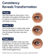 Load image into Gallery viewer, Under Eye Cream for Puffiness and Bags Under Eyes 1 fl oz Eye Bags Treatment for Men Women Anti Wrinkle Cream for Dark Circles Baggy Eyes Treatment for Women with Retinol Hyaluronic Acid & Caffeine