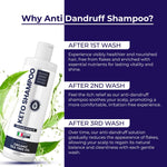 Load image into Gallery viewer, Anti Dandruff Shampoo pack 2 with Scalp Brush Sulfate Free Medicated Clarifying