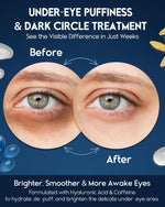 Load image into Gallery viewer, Under Eye Cream for Puffiness and Bags Under Eyes 1 fl oz Eye Bags Treatment for Men Women Anti Wrinkle Cream for Dark Circles Baggy Eyes Treatment for Women with Retinol Hyaluronic Acid & Caffeine