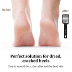 Load image into Gallery viewer, Stainless Steel Foot File Callus Remover with Handle & Dead Skin Container Foot Scraper for Calluses Dry Hard Skin Removal High Grade Feet Scrubber for Heels Exfoliation