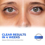 Load image into Gallery viewer, Retinol Eye Cream for Puffiness and Bags Under Eyes Hyaluronic Acid Peptide