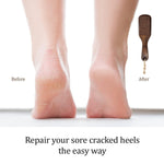 Load image into Gallery viewer, Pumice Stone Foot Brush Scrubber Wooden Pedicure Foot File with Handle for Dry Dead Skin Corn & Callus Remover for Feet Foot Scraper Exfoliating Brush for Heels Elbows Hands