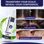 Load image into Gallery viewer, Scalp Psoriasis Shampoo Flakes Anti Dandruff Itchy Scalp Treatment for Seborrheic Dermatitis & Folliculitis Anti Fungal Medicated Solution for Itchy Flaky & Dry Hairs