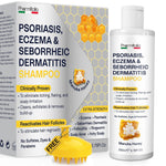 Load image into Gallery viewer, Psoriasis Shampoo for Dry Itchy Scalp Psoriasis Scalp Treatment for Eczema Relief Seborrheic Dermatitis Ringworm & Folliculitis Itchy Scalp Shampoo for Flakes Acne with Manuka Honey