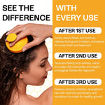 Load image into Gallery viewer, Psoriasis Shampoo for Dry Itchy Scalp Psoriasis Scalp Treatment for Eczema Relief Seborrheic Dermatitis Ringworm & Folliculitis Itchy Scalp Shampoo for Flakes Acne with Manuka Honey