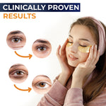 Load image into Gallery viewer, Under Eye Patches For Puffy Eyes And Dark Circles 30 Pair Eye Masks Anti Aging