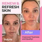 Load image into Gallery viewer, Collagen Peptides Powder 5 LB for Women Hydrolyzed Collagen Protein Types I and