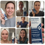 Load image into Gallery viewer, Psoriasis Scalp Spray   Dandruff Spray with Salicylic Acid 3% Treatment for Flaking Itching &amp; Dryness   Fast Absorbing Scalp Relief for Dandruff Folliculitis Seborrheic Dermatitis &amp; Eczema