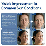 Load image into Gallery viewer, Glycolic Acid Pads   Resurfacing Pads for Face 20%   Exfoliating Peel Pad for Body and Dark Spots   Fine Lines and Wrinkles   60 Count