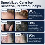 Load image into Gallery viewer, Psoriasis Scalp Spray   Dandruff Spray with Salicylic Acid 3% Treatment for Flaking Itching &amp; Dryness   Fast Absorbing Scalp Relief for Dandruff Folliculitis Seborrheic Dermatitis &amp; Eczema