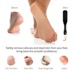 Load image into Gallery viewer, Pumice Stone Foot Scrubber   Pedicure Foot File with Handle for Dry Dead Skin