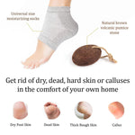 Load image into Gallery viewer, Pumice Stone for Feet &amp; Moisturizing Heel Sleeves Natural Lava Foot Stone Callus Removing Set Cracked Heel Treatment Foot Care Kit for Dry Cracked Feet Body Hands