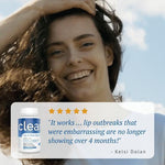 Load image into Gallery viewer, Lip and Skin Health 12B CFU Probiotic Strains Against Cold Sore Outbreaks