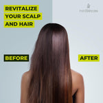 Load image into Gallery viewer, Tea Tree Shampoo and Conditioner Set with Castor Oil Rosemary Oil for Hair