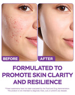 Load image into Gallery viewer, Dim Supplement 370mg Complex with Zinc Niacinamide Estrogen Blocker for Women &amp; Men Hormone Balance Hormonal Acne Menopause and Antioxidant Support Diindolylmethane 30 Capsules