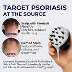 Load image into Gallery viewer, Scalp Psoriasis Shampoo Flakes Anti Dandruff Itchy Scalp Treatment for Seborrheic Dermatitis &amp; Folliculitis Anti Fungal Medicated Solution for Itchy Flaky &amp; Dry Hairs
