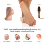 Load image into Gallery viewer, Pumice Stone for Feet &amp; Foot Brush with Handle 2 in 1 Natural Wood Pedicure