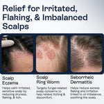 Load image into Gallery viewer, Psoriasis Scalp Spray   Dandruff Spray with Salicylic Acid 3% Treatment for Flaking Itching &amp; Dryness   Fast Absorbing Scalp Relief for Dandruff Folliculitis Seborrheic Dermatitis &amp; Eczema